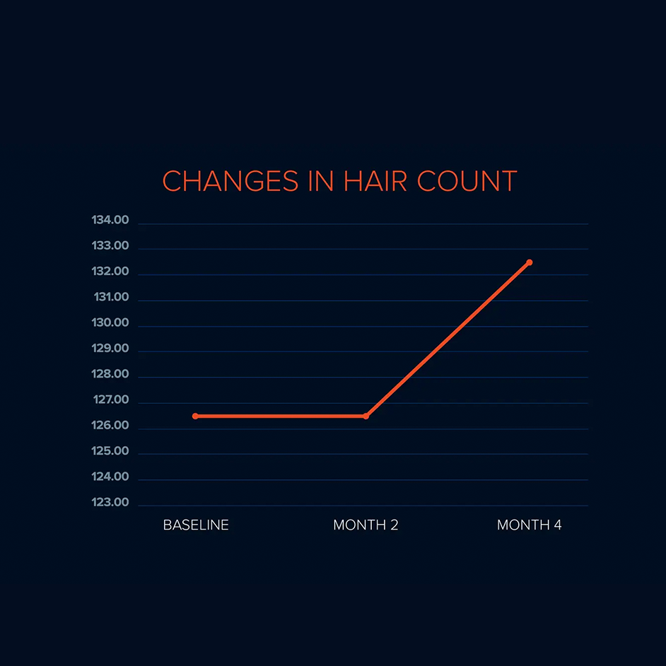 FOLIGAIN Triple Action Complete Formula For Thinning Hair For Women with 10% TRIOXIDIL®