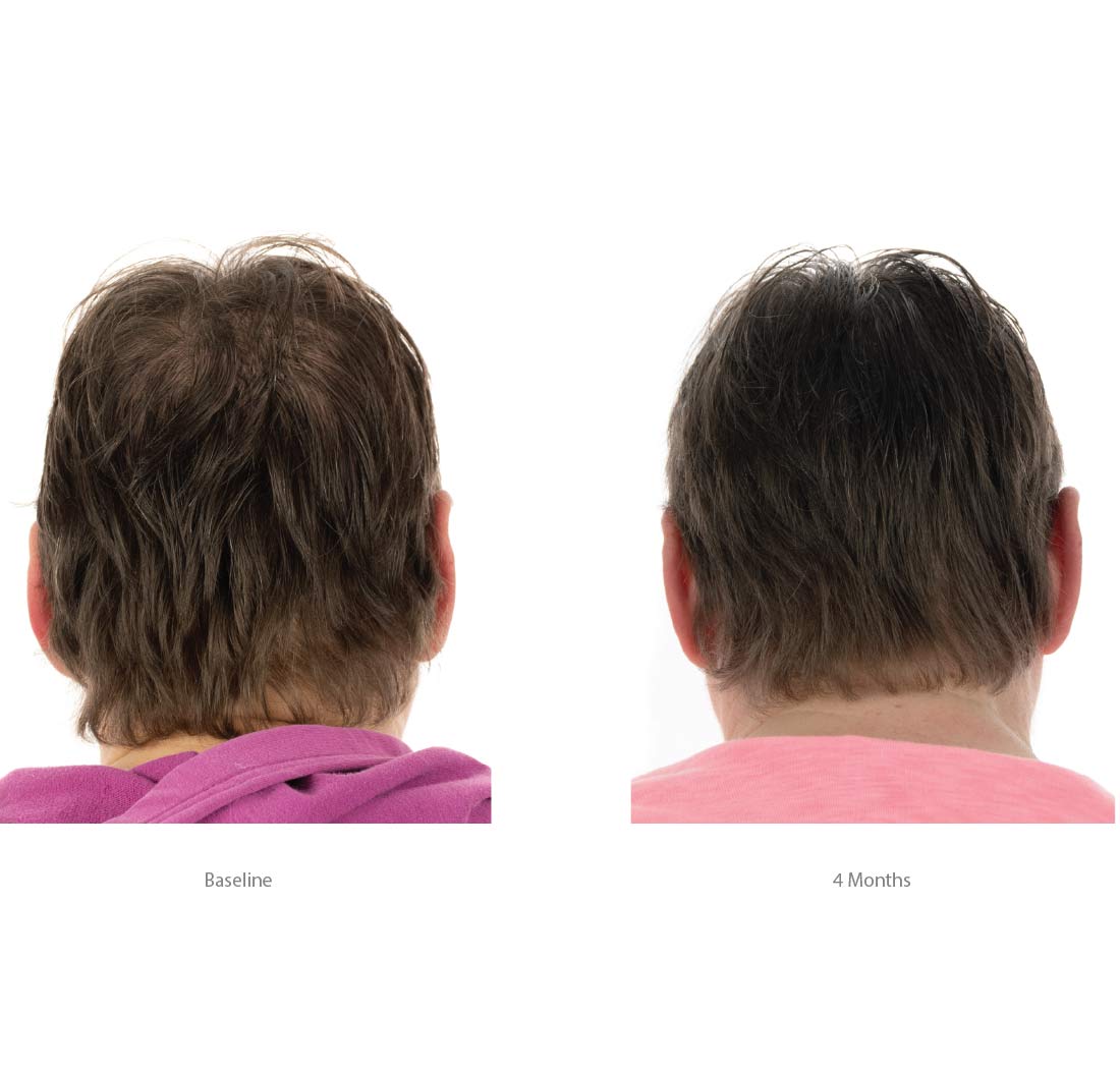 FOLIGAIN Triple Action Conditioner For Thinning Hair For Women with 2% TRIOXIDIL® 473ml